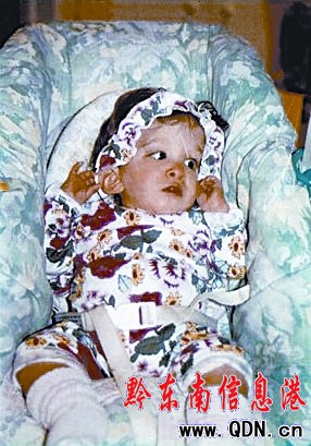 美國(guó)16歲女孩貌如6月大女嬰(圖)