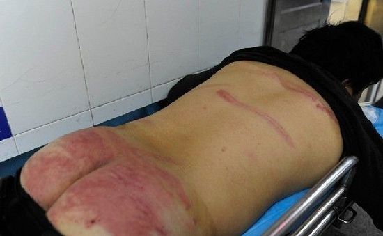 深圳小販被城管暴打 數(shù)人稱其被拖上執(zhí)法車(圖)